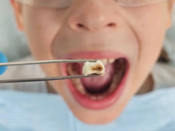 Best After-Hours Emergency Dentist in Compo, CT